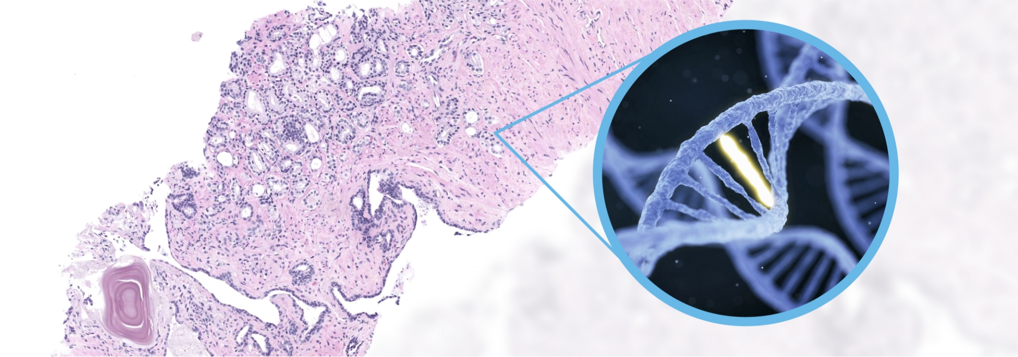 A microscopic tissue sample with a magnified DNA strand.