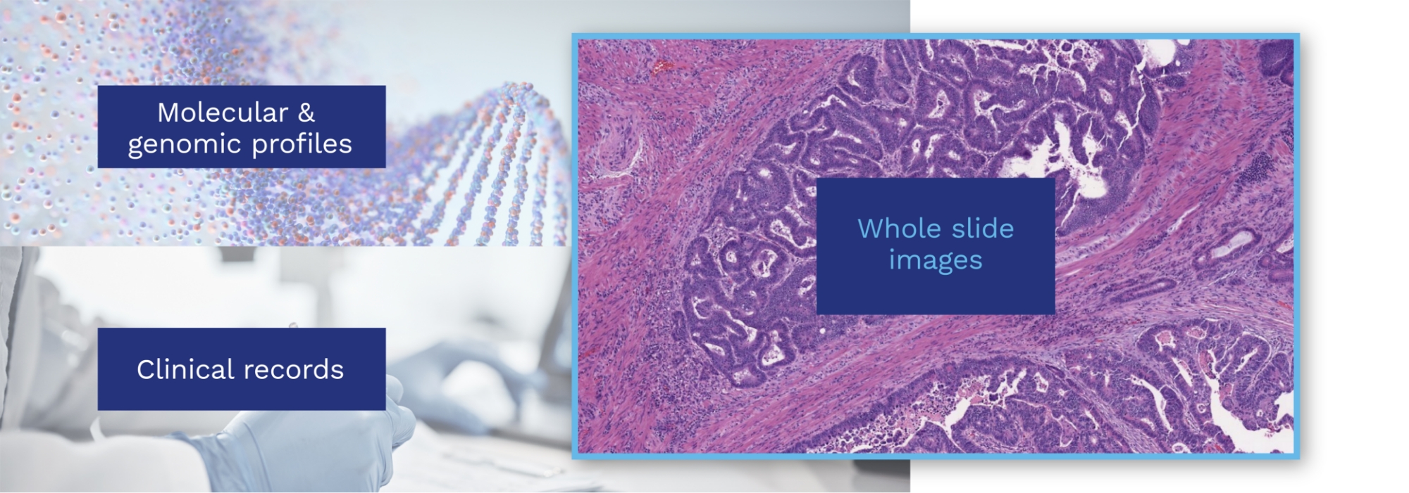 A composite image highlighting molecular and genomic profiles, clinical records, and whole slide images used in medical analysis.