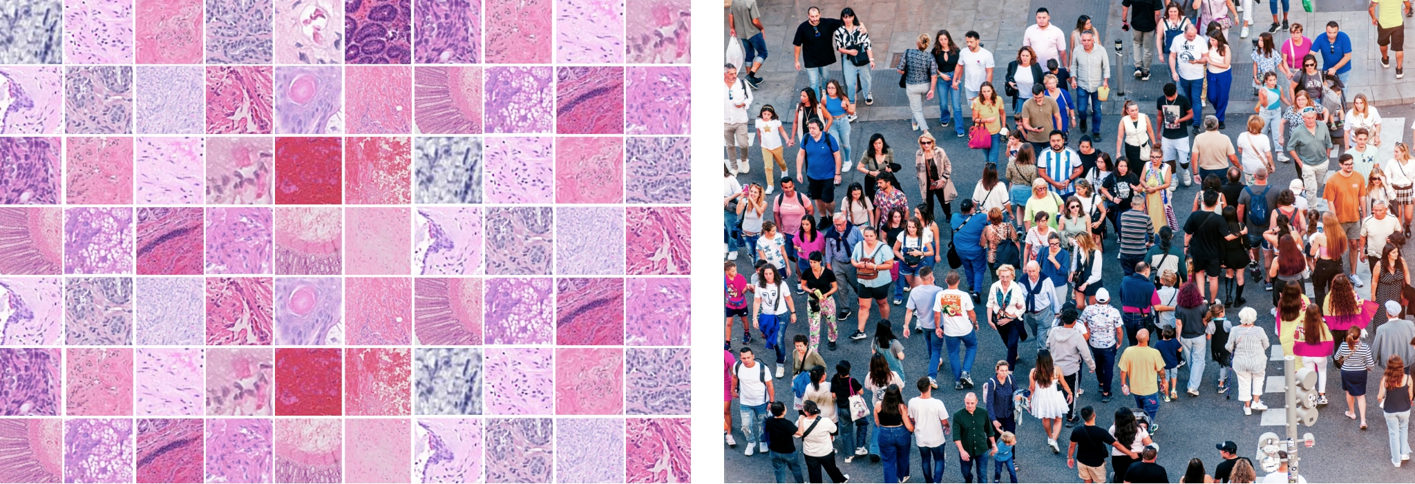 Side-by-side comparison of pathology tissue samples and a diverse crowd of people.